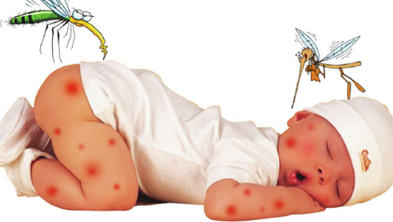 Trẻ bị sốt xuất huyết