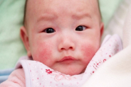 Đau đầu với những bệnh thường gặp ở trẻ nhỏ