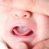 trẻ 4 tháng tuổi và những triệu chứng nguy hiểm thường gặp