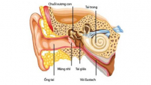 Trẻ vị viêm tai giữa nguyên nhân và cách điều trị bệnh viêm tai giữa